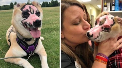 Photo of Shiba Inu Who Survived House Fire Becomes Therapy Dog For Burn Victims