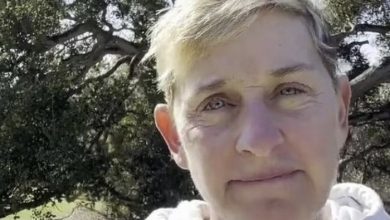 Photo of ‘Incredibly painful,’ says Ellen DeGeneres. ‘I had no idea that was a symptom.’