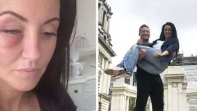 Photo of This Brave Woman Claims That Having A Stroke Was The Best Thing That Has Ever Happened To Her