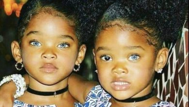 Photo of These Are The Incredible “Trueblue Twins”