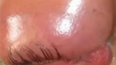 Photo of Crucial Techniques for Preventing Infections in Your Eyes