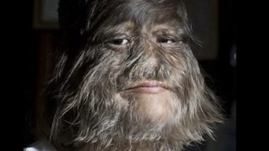 Photo of World’s Hairiest Girl Embraces Change After Meeting Soulmate – See Her New Look