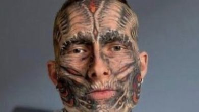Photo of Revealing the Enigmatic Transformation – An American’s Journey from Tattooed to Tattoo-Free Beauty