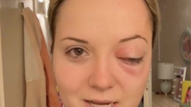 Photo of Doctors tell young woman to leave emergency room as she just has ‘anxiety’ – months later, horrific truth is discovered