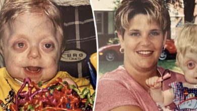 Photo of Teen who wasn’t expected to live past 18 months graduates high school – well done, Braden