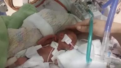 Photo of The amazing story of Tru Beare, born weighing just 1 pound