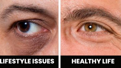 Photo of 10 Symptoms That May Reveal Health Problems