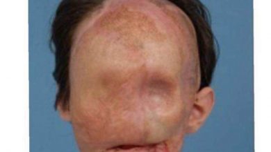 Photo of This transformation is incredible… See the result after surgery below…