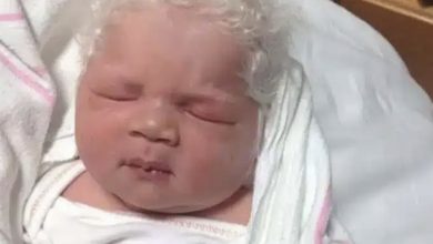Photo of When the doctor took her baby out of her womb and looked at him, he was speechless!