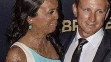 Photo of After suffering severe burns her husband was asked why he didn’t leave her…