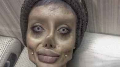 Photo of Before 50 plastic surgeries, the girl with the face “like” Angelina Jolie used to be this beautiful