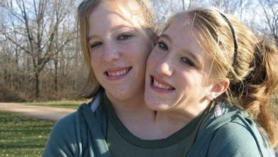 Photo of «One husband for two sisters!😱 Siamese twins revealed their wedding pictures!»🤔