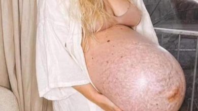 Photo of Harsh Remarks Including Her Huge Belly. “The worst pregnant belly I have ever seen”