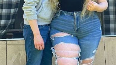 Photo of True Love Defies Beauty Standards