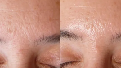 Photo of Different Things That Clog Your Pores And Cause Acne