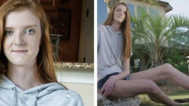Photo of 7-Year-Old Sensation Sets World Record with Extraordinarily Long Legs