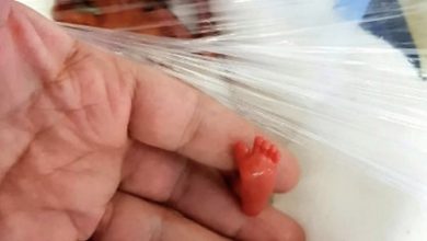 Photo of She weighed less than a pound at birth and doctors thought she would not survive