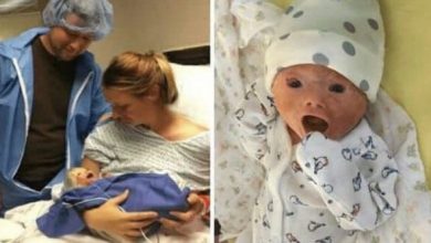 Photo of Doctors perform an emergency C-section and give birth to a baby with a rare skin disease.