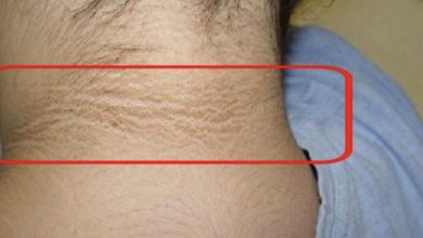 Photo of A mark on their daughter neck made them overthink – after the doctor appointment, everything changed