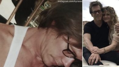 Photo of Fans were worried about Sosie, daughter of Kevin Bacon and Kyra Sedgwick, after her hand’s appearance in an Instagram post