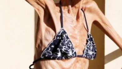 Photo of World’s Thinnest Woman Receives Fan Mail to Be Like Her