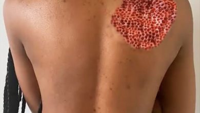 Photo of 10 Signs Showing Something Is Wrong in Your Body