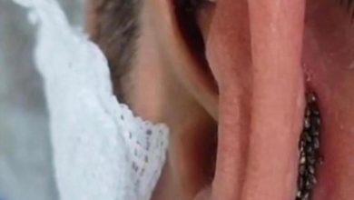 Photo of Ear Infection: 6 Signs You Have It