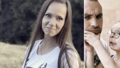 Photo of A couple adopts an undesirable ‘freak’ kid who was abandoned at birth, and you can see him now