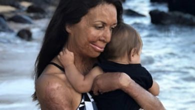 Photo of Eighty Percent of Her Mother’s Affection and Selflessness Devoted Exclusively to Her NT