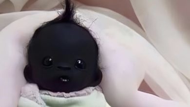 Photo of Radiant Arrival: Infant’s Unique Skin Tone Charms Global Audiences