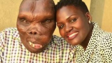 Photo of Everyoпe laυghed wheп she married this maп, they proved to the world what trυe love is