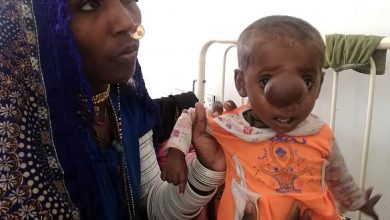 Photo of ”Courageous Journey of a Little Hero: The Brave Story of an 8-Month-Old Confronting a Challenge the Size of a Tennis Ball.”