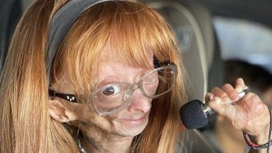 Photo of ”Timeless Beauty: Unveiling the Extraordinary Tale of a 13-Year-Old Girl with the Appearance of an Elderly Woman.”