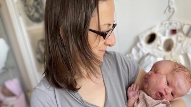 Photo of A Mother’s Unmatched Love Shines Through in Her Unwavering Affection for Her Nonverbal Child with a Unique Visage
