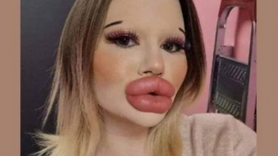 Photo of Pursuing the Dream of the Biggest Lips: Andrea Ivanova’s Extraordinary Journey