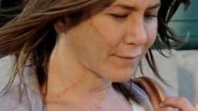Photo of Jennifer Aniston opens up about her plastic surgery, says she’ll never inject “s**t into my face”