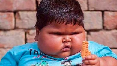 Photo of “Not a little baby”: how does the girl, weighing 18kg at the age of 1, look like now?