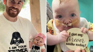 Photo of Miracle amidst imperfections: The story of a father’s love and acceptance when giving birth to a child with birth defects, touched millions of people.