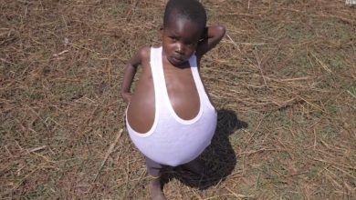 Photo of A Father’s Unconditional Affection Mirrored in His 5-Year-Old’s Belly.