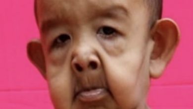 Photo of Decoding the Mystery: The Intriguing Tale of ‘The Boy Who Resembles an Old Man’