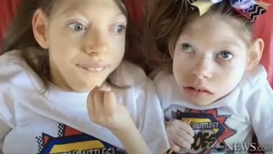 Photo of Against All Odds: The Hartley Family’s Unbreakable Bond with Microcephaly