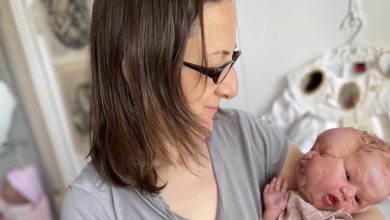 Photo of A Mother’s Unmatched Love Shines Through in Her Unwavering Affection for Her Nonverbal Child with a Unique Visage