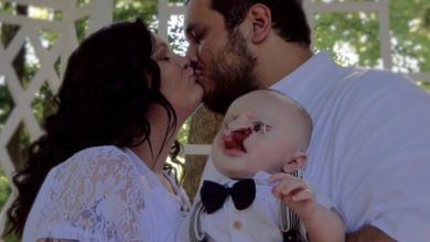 Photo of A Mother’s Unwavering Love: Tireless Devotion to a Child with a Congenital Anomaly Radiates Boundless Affection