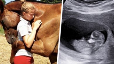Photo of Horse Keeps Hugging Pregnant Woman – When Doctor Looks At Ultrasound He Calls The Police