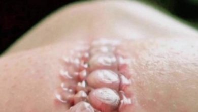 Photo of Ten Signs That Your Body Is Not in Balance