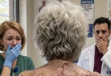 Photo of Everyone Thought the 76-Year-Old Woman Was Losing Her Mind—Until Her Caregiver Saw Her Back