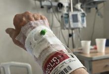 Photo of I Went Into the Hospital for Surgery. Then My Nurse Asked Why My Daughter Had Told Everyone I Was Already Dead.