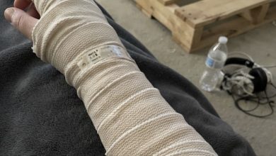 Photo of My Arm Was Wrapped From My Wrist to My Shoulder After Surgery. Then My 11-Year-Old Son Asked Me a Question That Made Me Realize What My Husband Had Been Hiding.